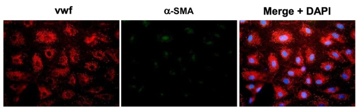 Immunofluorescence images of human intestinal microvascular endothelial cells stained with von Willebrand factor (VWF), alpha-smooth muscle actin (a-SMA), and DAPI.