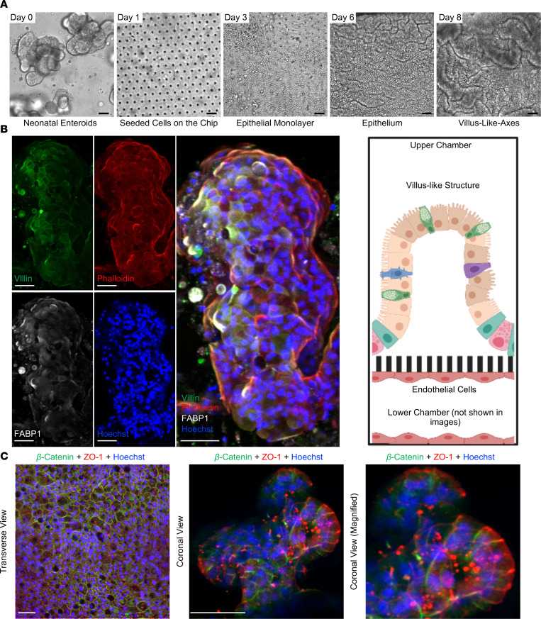 Creation of the Neonatal-Intestine-on-a-Chip microfluidic model.