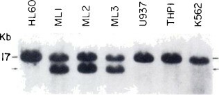 Cµ-related sequences in DNA of human myeloid leukemic cell lines.