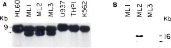 Configuration of JH segment in human myeloid leukemic cell lines.