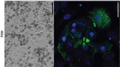 Primary human hepatocytes.