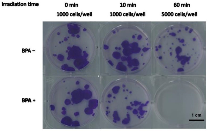 Autophagy induction impairs migration and invasion in HSC-4 cells.