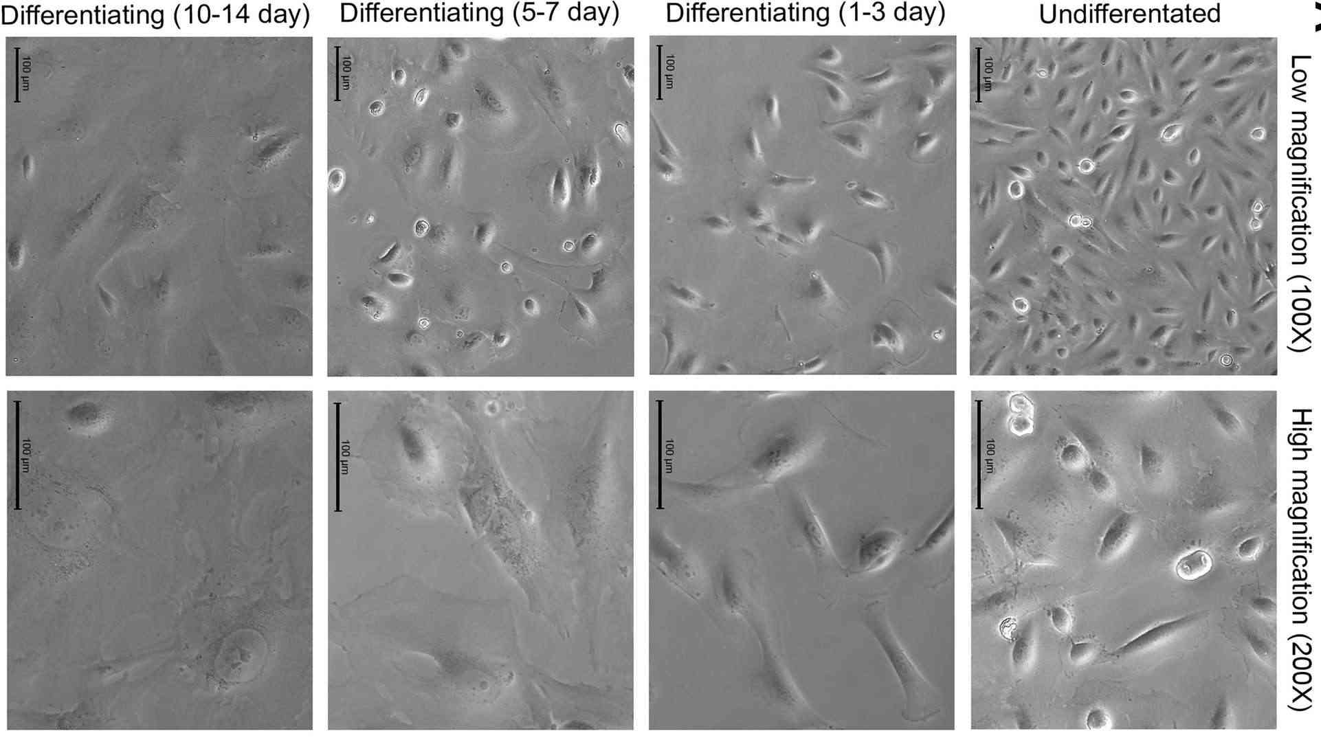 Differentiated human immortalized podocytes identification.