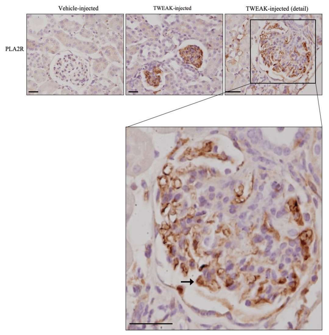 TWEAK enhances PLA2R expression in podocytes in vivo.