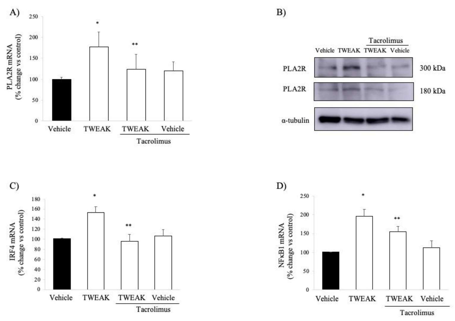 TWEAK enhances PLA2R expression in cultured human podocytes: effects of tacrolimus.