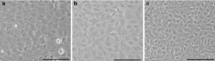 Primary (a), passage 10 (b), and passage 40 (c) bovine corneal endothelial cells exhibited the typical morphology associated with corneal endothelial cells.