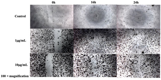 BCECs were subjected to a migration assay under different D-SPION concentrations over 16 and 24 hours.