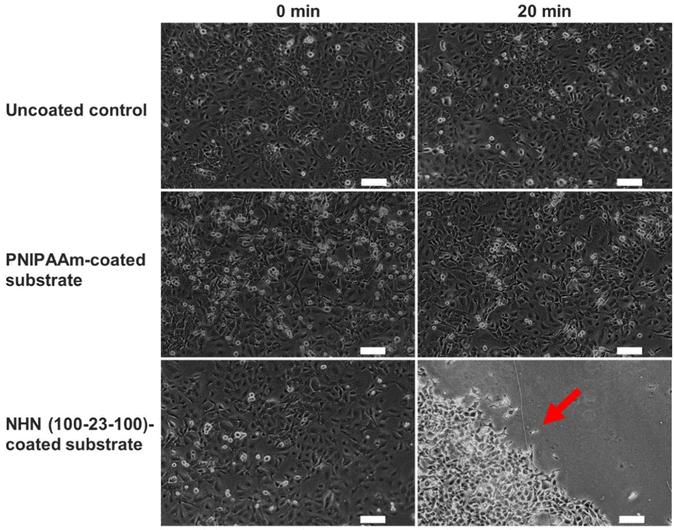 Phase contrast images of cultured bovine endothelial cells were captured at 0 minutes and 20 minutes after cooling at 4°C on uncoated, PNIPAAm-coated, and NHN(100-23-100)-coated substrates.