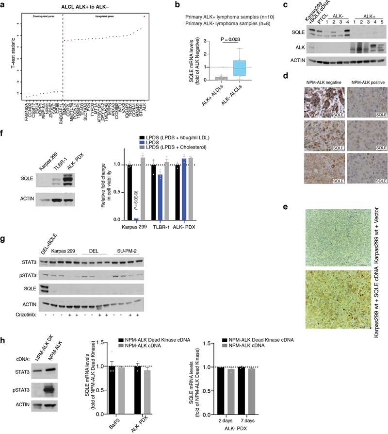 Absence of SQLE expression in primary ALK<sup>+</sup> ALCLs.