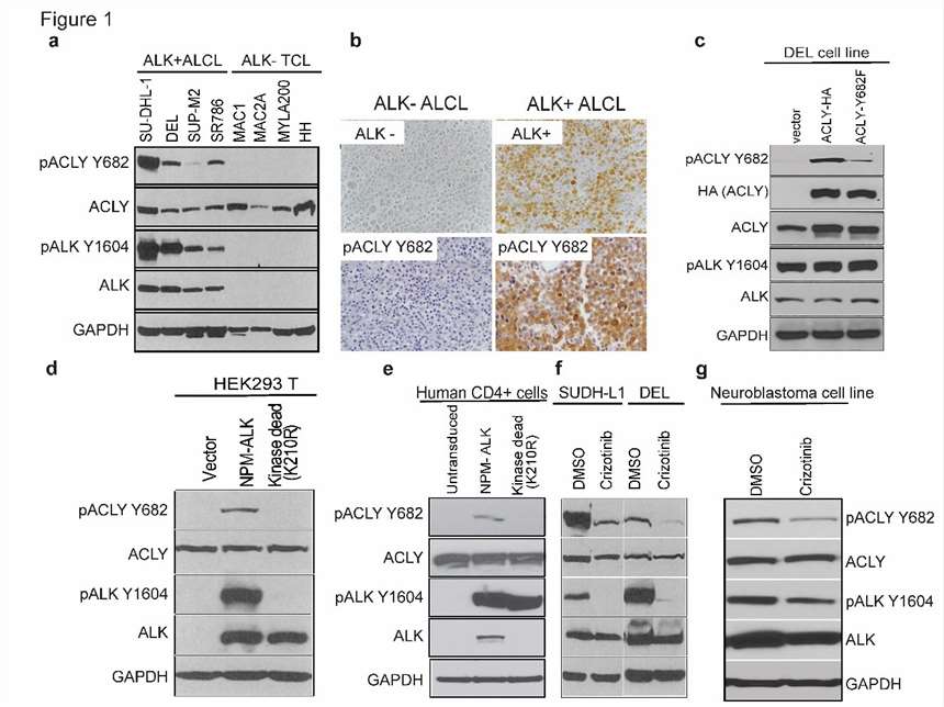 NPM-ALK Phosphorylates ACLY at Y682 in ALK<sup>+</sup> ALCLs.