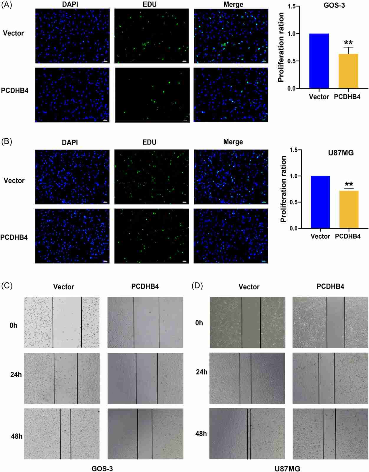 PCDHB4 inhibited the proliferation and migration of GBM cells.