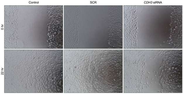 After transfection, HuCCT1 cells were scratched and allowed to migrate for up to 22 h.