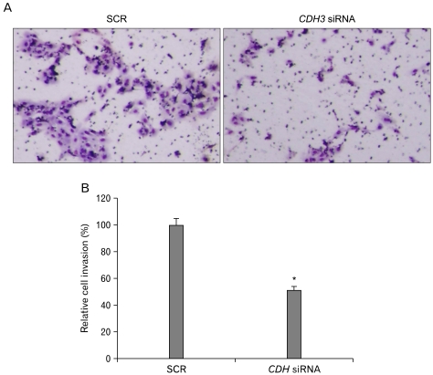 After transfection, HuCCT1 cells were allowed to invade through the matrigel for up to 36 h. Invaded cells were stained with hematoxylin/eosin (A) and counted to quantify (B).