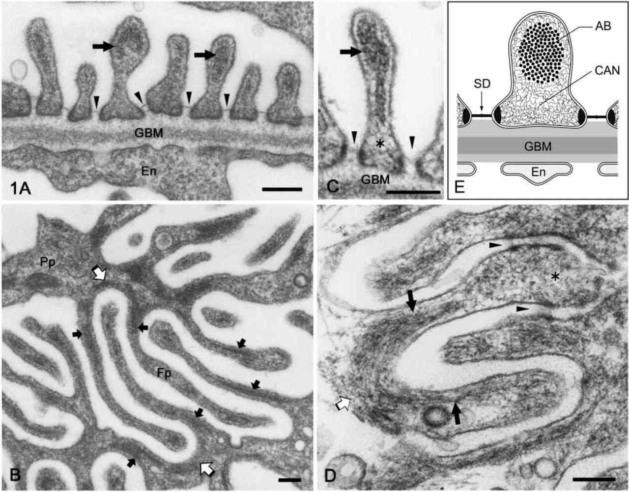 Electron microscopy images depicting the foot processes of rat podocytes.