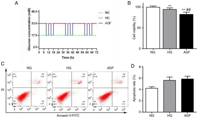 Impact of acute blood glucose fluctuations on the proliferation and apoptosis of rat podocytes.