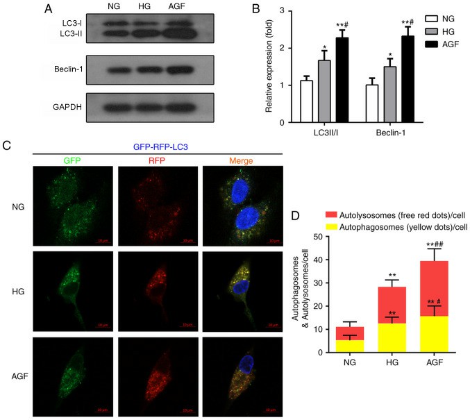 AGF induces rat podocytes’ autophagy. 