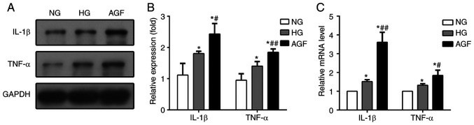 Acute glucose fluctuations enhance the production of pro-inflammatory cytokines.