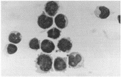 Morphology of SEM cells with Pappenheim's staining.