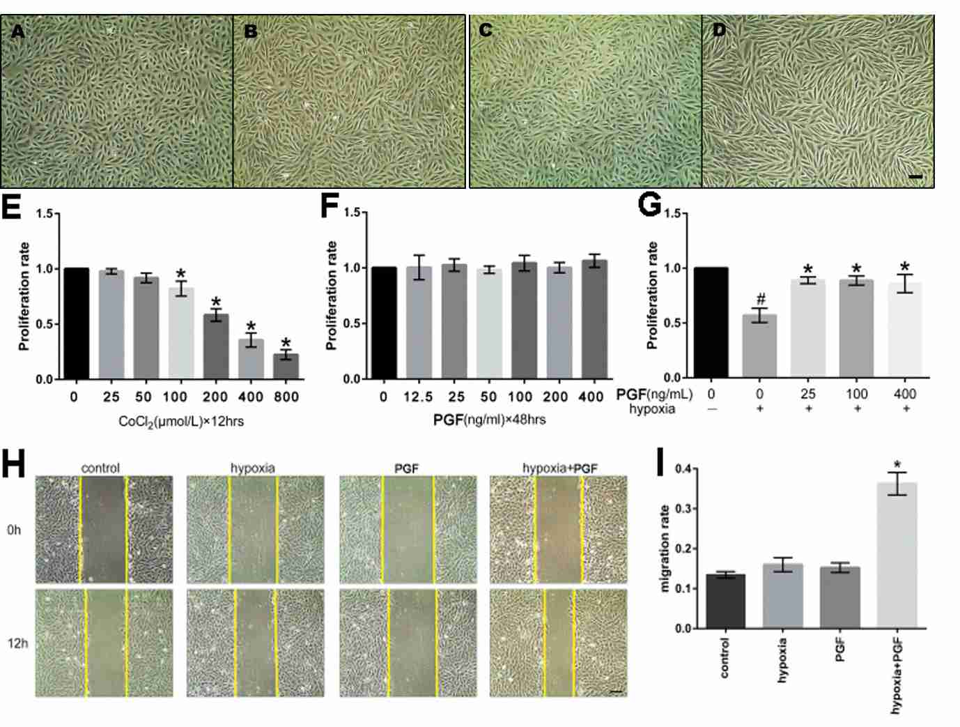 (A-D) Influence of external PGF on the morphological alterations of ARPE-19 cells during hypoxic conditions. (E-G) Impact of hypoxia and PGF on the proliferation rate of ARPE-19 cells. (H-I) Influence of external PGF on the migration of ARPE-19 cells under hypoxic conditions.