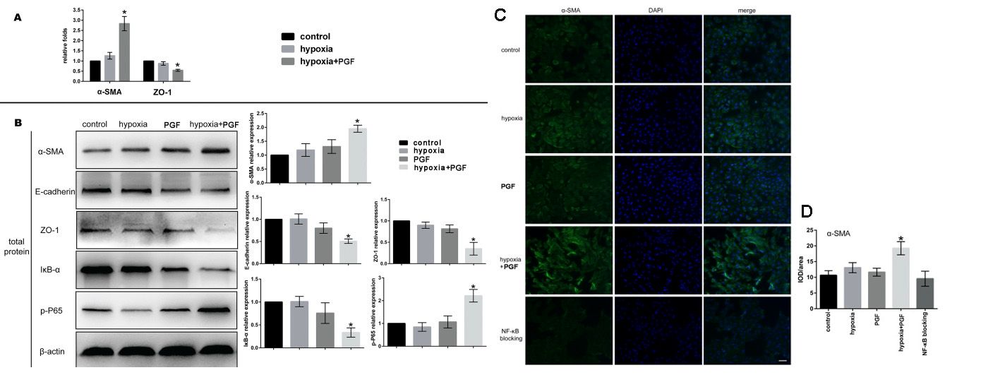 Effects of external PGF on EMT processes in ARPE-19 cells during hypoxia.