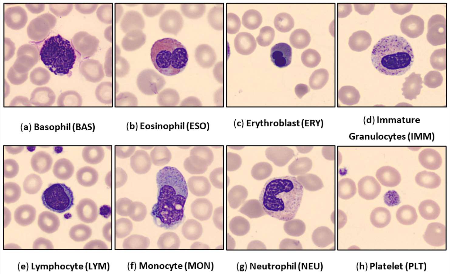 Images of human peripheral blood cells (HPBC) representing all eight classes.