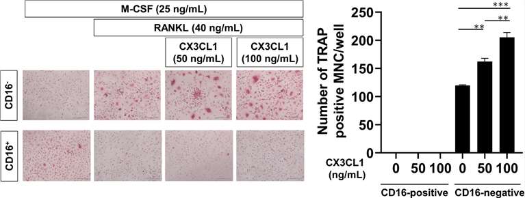 CX3CL1-induced differentiation of peripheral blood monocytes into osteoclasts.