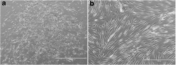 Contrast of primary cultured human skeletal muscle cells and mature myotubes' low-resolution phase.