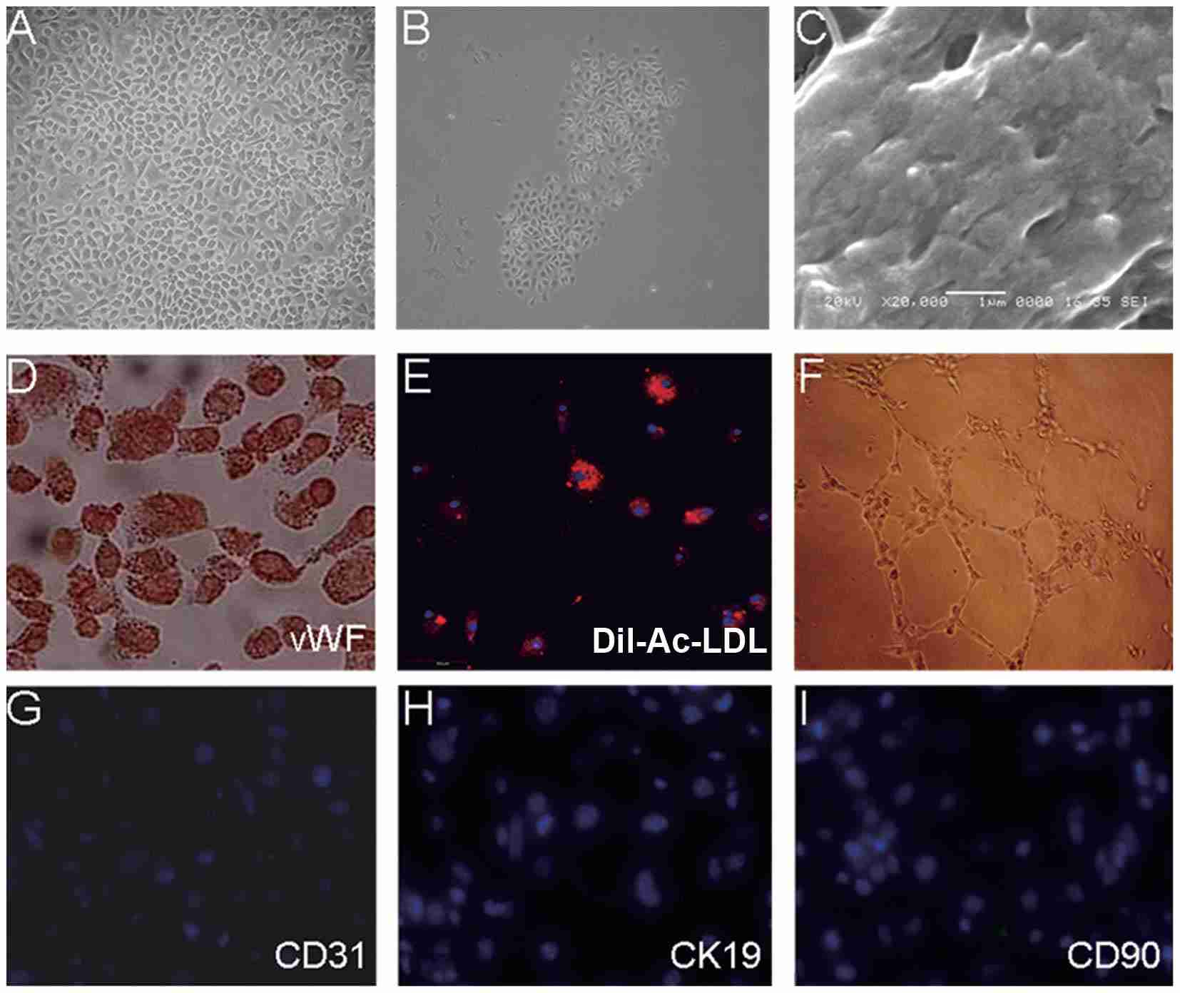 Characterization of MHSECs.