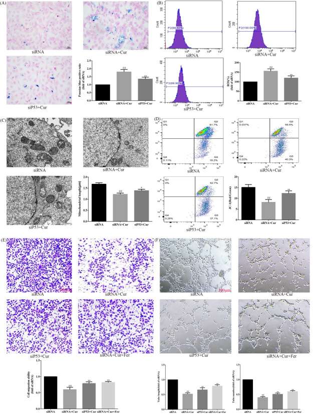 Curcumol influences P53 to control angiogenesis through ferroptosis mediation.