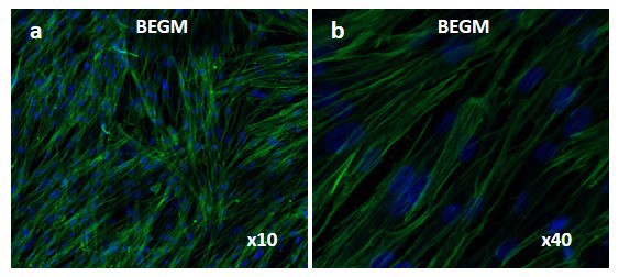 Laser confocal microscopy captured images of WI-38 cells grown in BEGM. The intermediate filaments labeled with anti-vimentin appear green, the nuclei are stained blue.