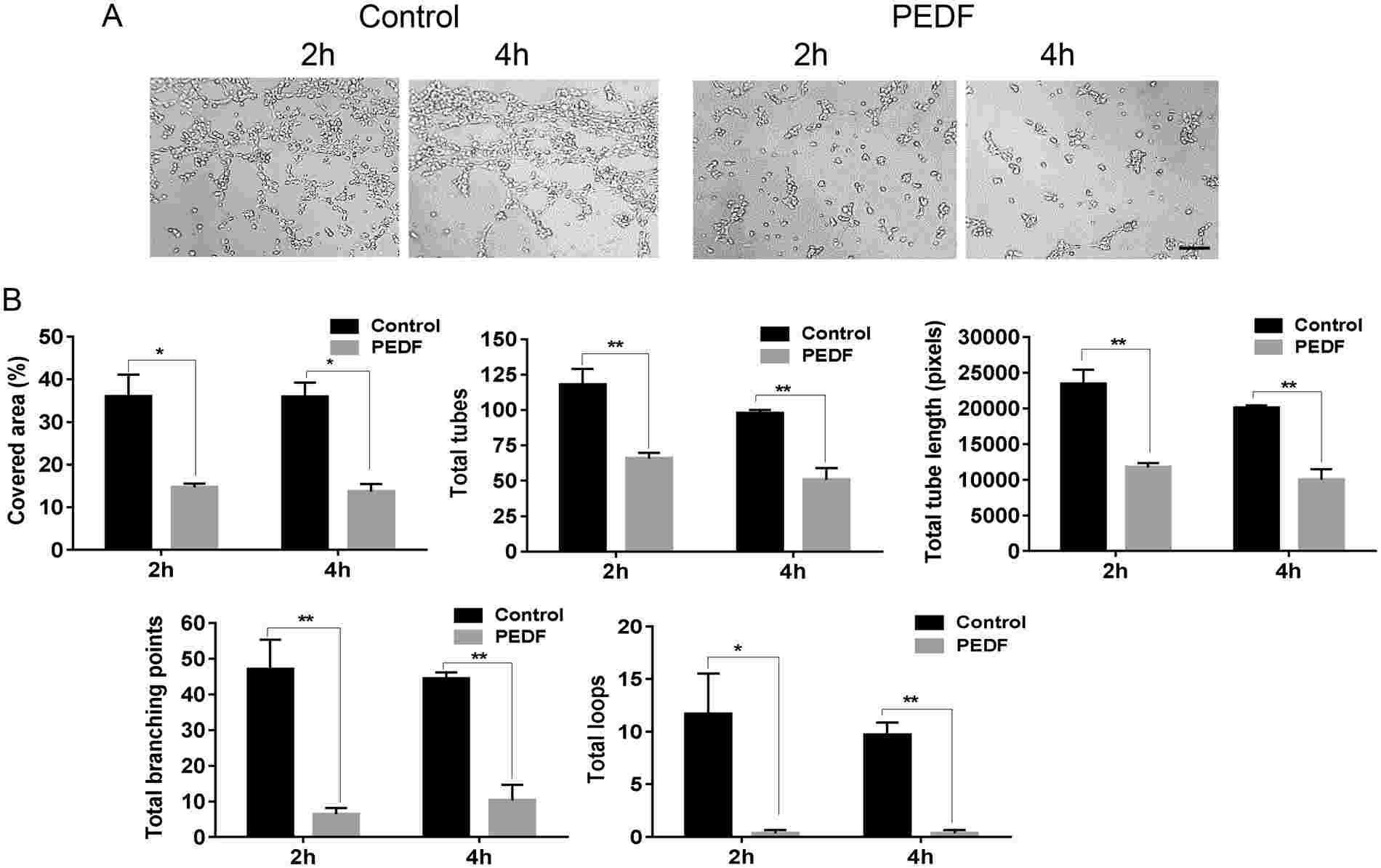 Effect of PEDF on the formation of endothelial cell tubes. MDMEC were cultured on Matrigel with or without the presence of PEDF (100 ng/ml).