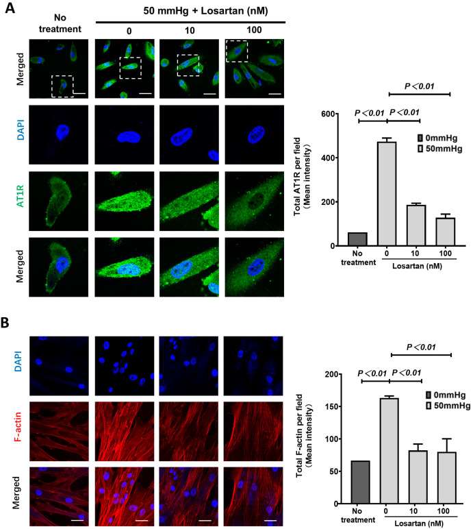 Images of immunofluorescence staining of AT1R and F-actin in human renal epithelial cells.