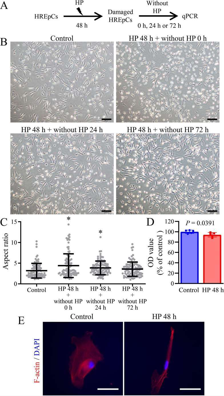 Long-term treatment with HP caused significant alterations in cell morphology and the expression of growth factors in HREpCs.