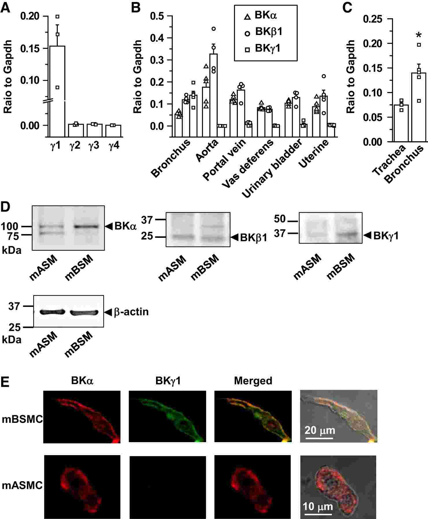 Large-conductance calcium-activated potassium channel γ1 subunit (BKγ1) is selectively highly expressed in mouse BSMs.