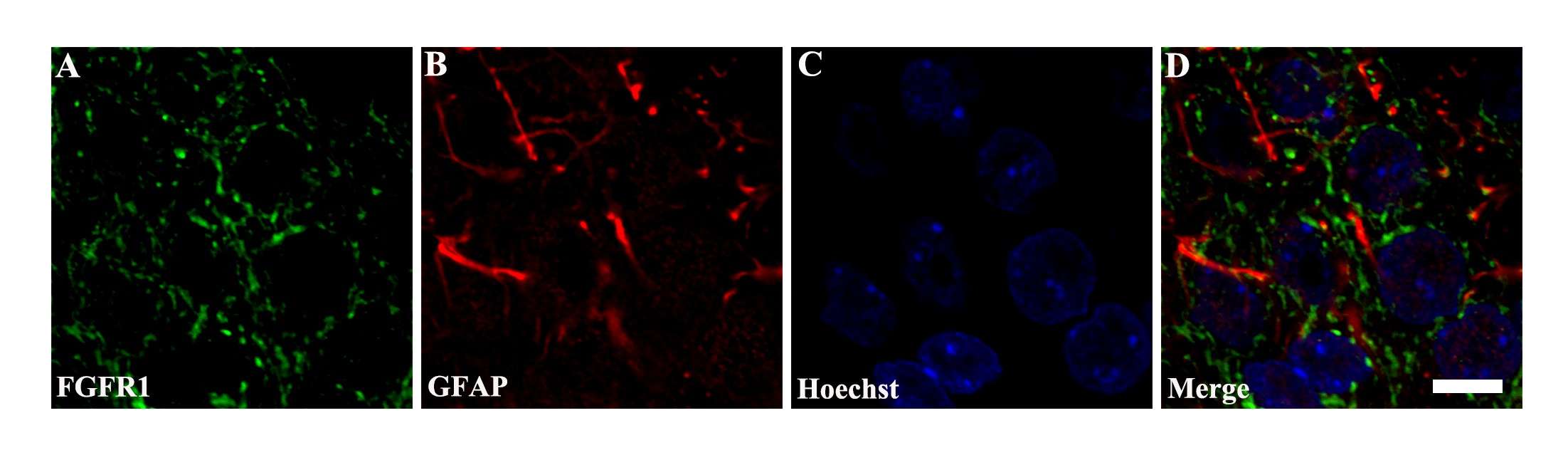 Observed co-localization of FGFR1 and GFAP in the hippocampal CA1 region.