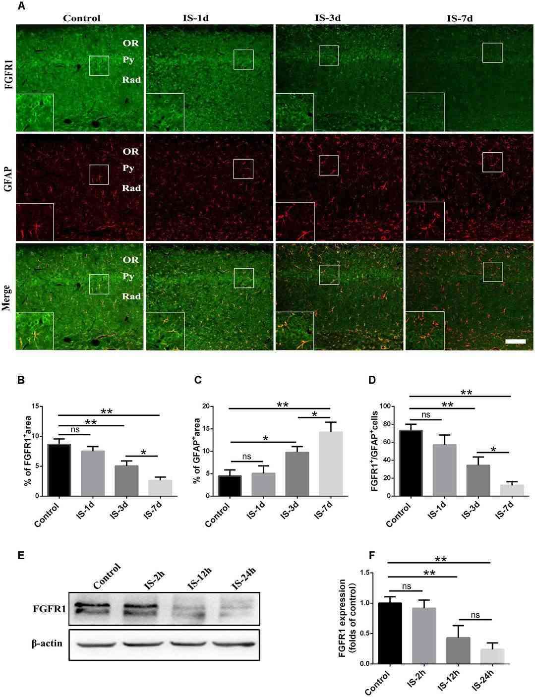 Alterations in FGFR1 expression following infrasound exposure.