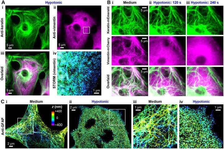 Comparing cytokeratin and GFAP elucidates the generalization of net-charge effects on the intracellular stability of intermediate filaments.