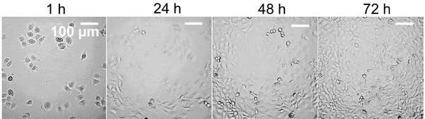 Cal33 cells' representative images.