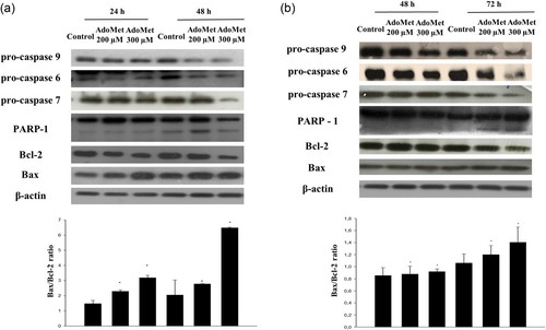 Effects of AdoMet on the expression levels of key proteins that regulate apoptotic pathways in head and neck cancer cells.