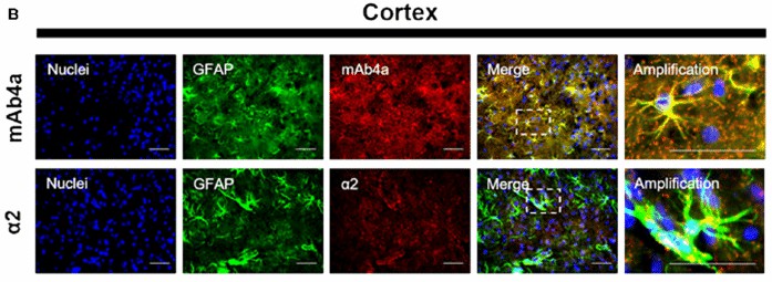 Astrocytes from the rat brain cortex are shown, with nuclei highlighted in blue using Hoechst stain, astrocytes marked in green with GFAP, and mAb4a/a2 immunoreactivity displayed in red.