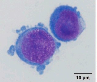 Image of Wright-Giemsa stained TF-1 cells.