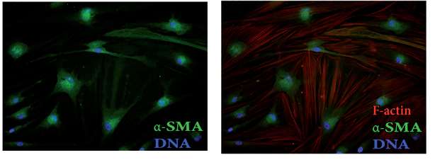 Images of F-actin cytoskeleton and α-SMA in human bronchial fibroblasts.