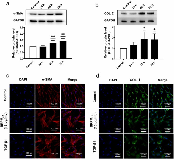 The impact of BRPM<sub>2.5</sub> on fibroblasts.