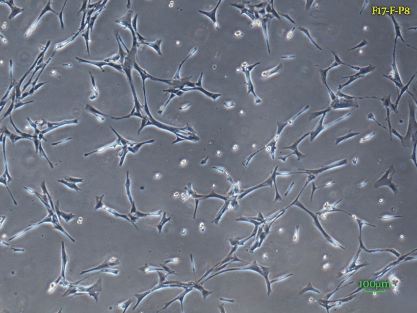 The morphology of fetal dermal fibroblasts was observed under a 40X inverted light microscope.