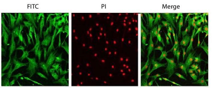 Human skin fibroblast cell lines were stained with DDR-2 antibody and PI.