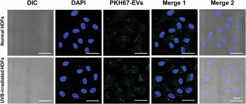 The internalization of HASC-derived EVs in both normal and UVB-exposed human dermal fibroblasts.