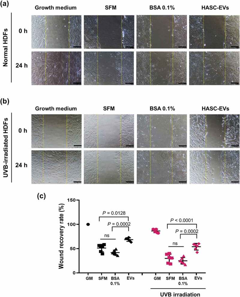 The influence of HASC-derived EVs on wound healing in UVB-damaged human dermal fibroblasts.