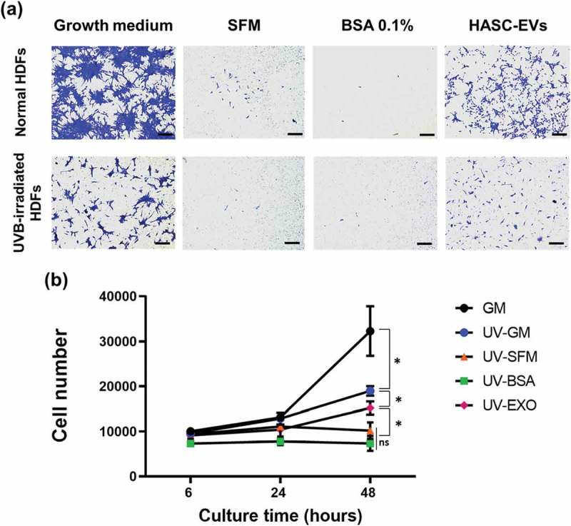 The effect of HASC-derived EVs on (a) the migration and (b) the proliferation of UVB-exposed human dermal fibroblasts.