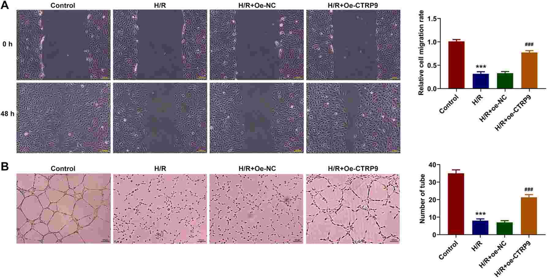 Overexpression of CTRP9 mitigates the impairment in migration and angiogenesis of HPVECs under H/R conditions.