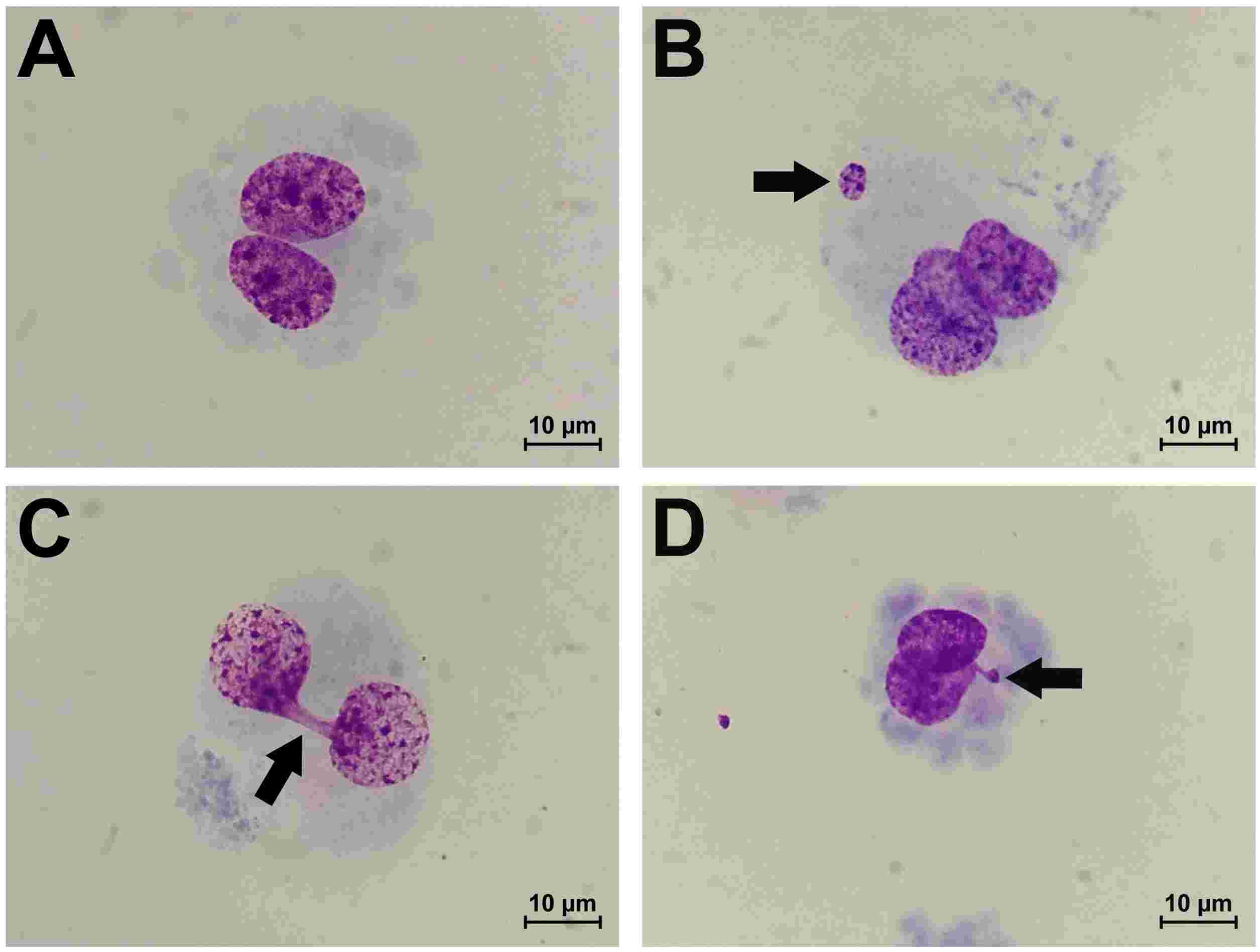 Morphology of undamaged binucleated (BN) endothelial cells (A), BN cells exhibiting micronuclei (MNi) (B), BN cells with nucleoplasmic bridges (NPB) (C), and BN cells with nuclear buds (NBUD) (D), observed at a magnification of ×1000.